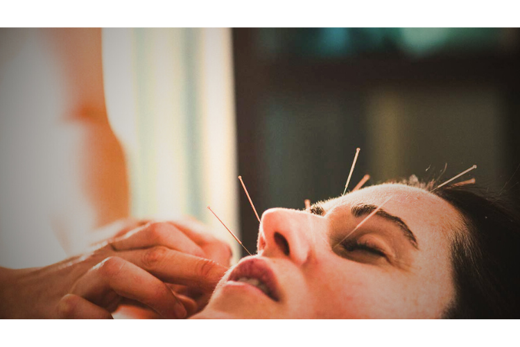 akupuntur menghambat penuaan