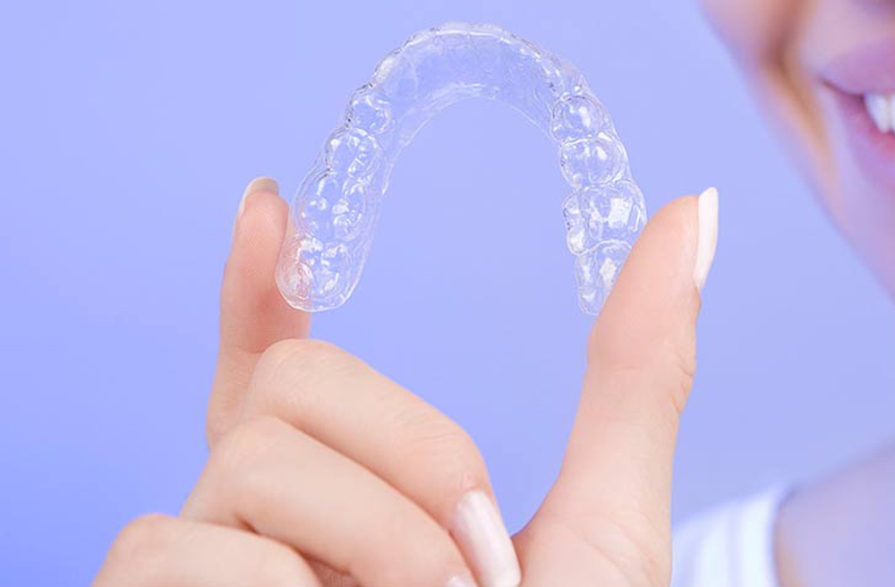 clear_aligner_behel_gigi