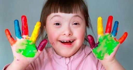 anak_down_syndrome_hiperaktif