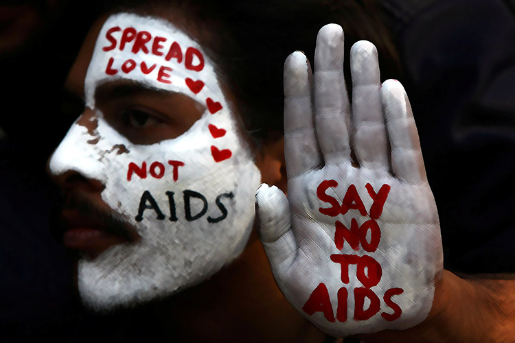 Penderita hiv aids bisa sembuh