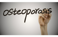 orang indonesia berisiko osteoporosis