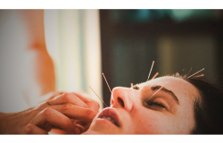 akupuntur menghambat penuaan