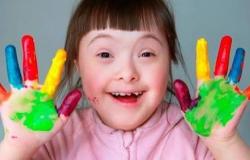anak_down_syndrome_hiperaktif