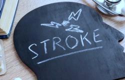golongan darah dan risiko stroke dini