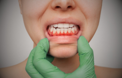 penyakit gusi perburuk diabetes dan sakit jantung