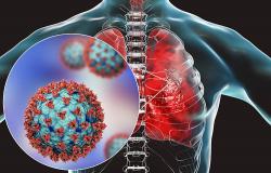 bisakah virus corona memicu kanker paru